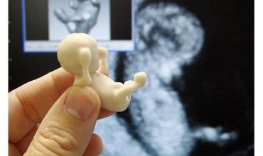 Súd v Británii prikázal katolíčke potratiť dieťa, pretože si myslí, že by bola zlou matkou